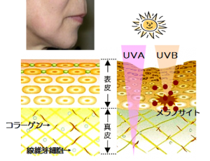 皮膚の断面図